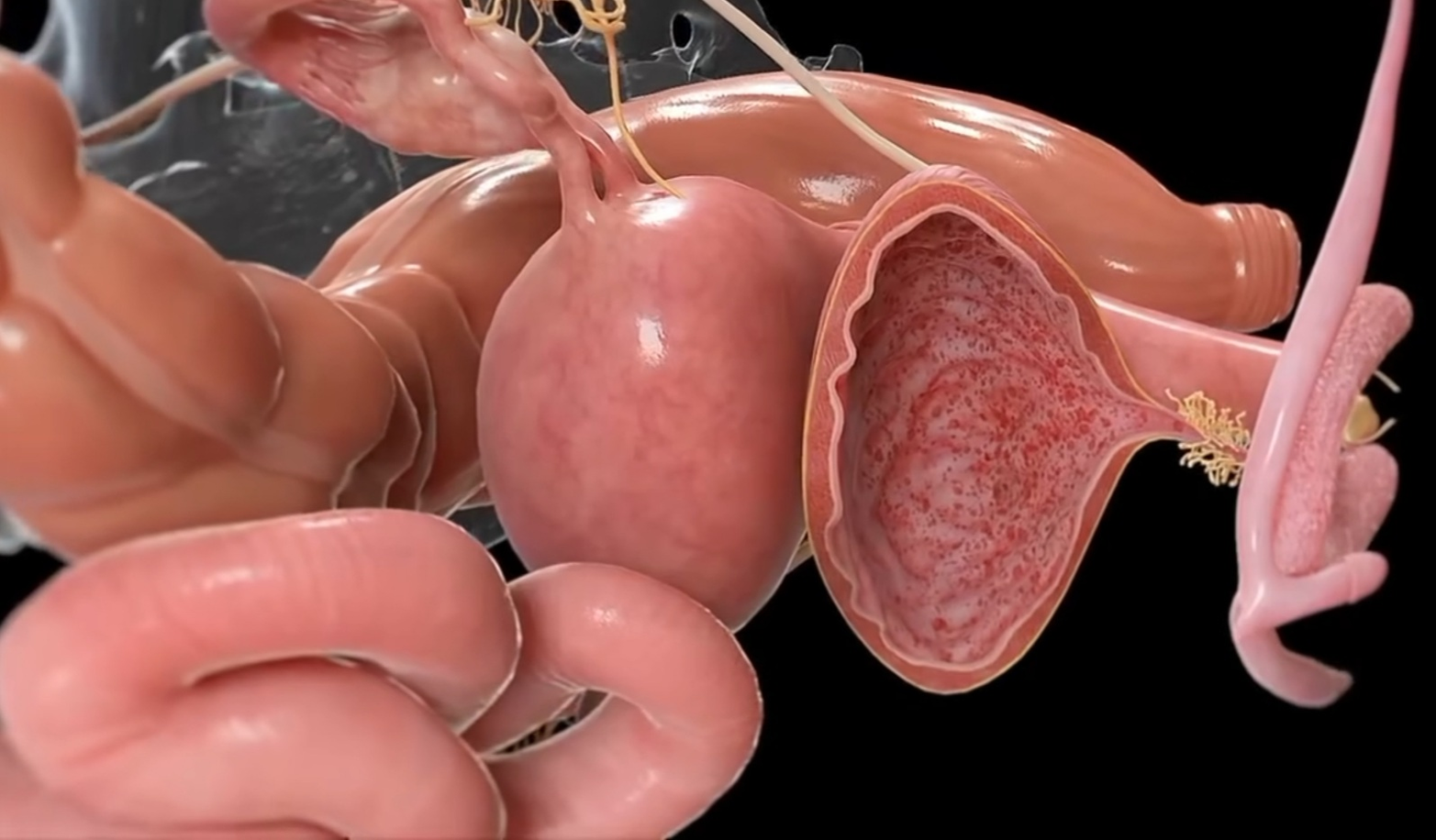 Sexually Transmitted Infections (STIs)